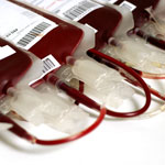 Eviter les transfusions inutiles